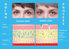 年轻的皮肤和老化的皮肤。弹性蛋白和胶原蛋白.