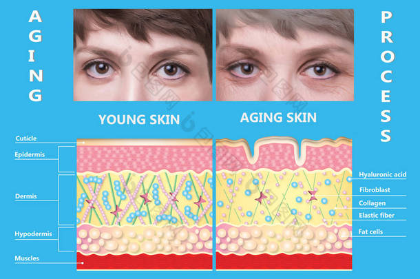 年轻的皮肤和老化的皮肤。弹性蛋白和胶原蛋白.