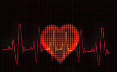 心形心电图 (Ecg) 痕迹的计算机艺术品。测量心脏的电活动.