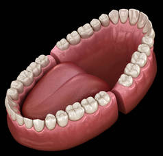 牙科解剖学 - 打开的假牙。医学上准确的牙科 3D 插图