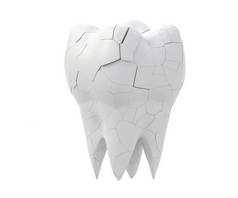 断了的牙齿和整个牙齿在白色的背景上隔离。3d说明