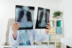 医生比较病人康复后的两片肺X光表现