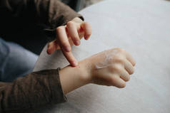 一个小孩用婴儿油弄脏了手上的红晕.用奶油、冻伤和剥皮进行治疗和护肤的概念。过敏问题