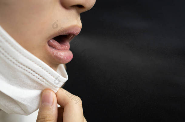 亚洲病人<strong>咳嗽</strong>而没有捂住嘴，没有用口罩捂住嘴和鼻子，在干咳的时候把医疗保护面罩拉到下巴下，有可能传播柯罗纳威COVID-19