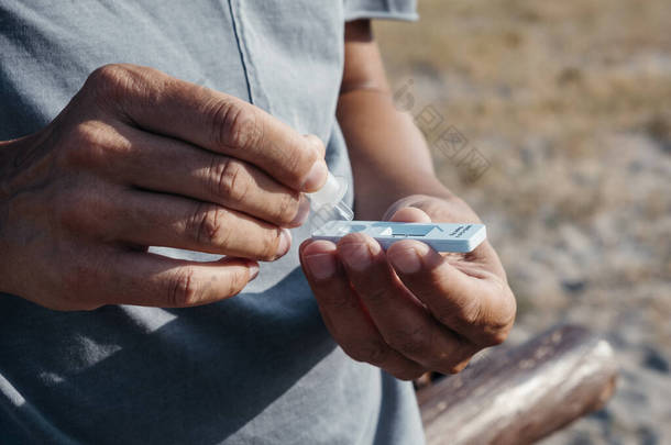 一名年轻的高加索男子穿着<strong>夏装</strong>，穿着休闲装，在室外用自己的样本进行covid-19抗原诊断测试，