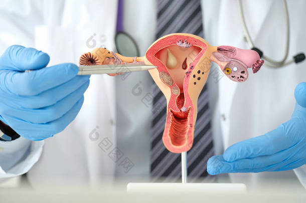 男性妇科医生用笔在人工子宫和卵巢的塑形模型上显示女性疾病
