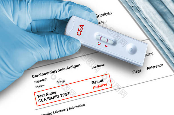 应用手握医用手套，背景为医用面罩的快速检测装置，检测致癌胚胎抗原阳性结果。CEA是一种检测肠癌的肿瘤标志物.
