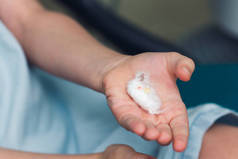 the child holds his torn temporary tooth in his hand