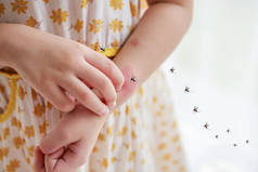 小女孩的皮疹过敏，手臂因蚊子叮咬而发痒