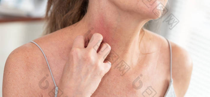 女人瘙痒并抓挠脖子过敏症状图片-包图网企业站