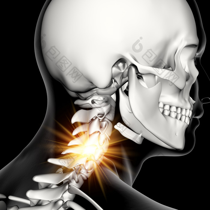 人体脖颈疼痛摄影图