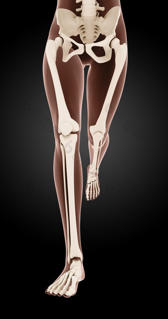 女医疗骨架腿2