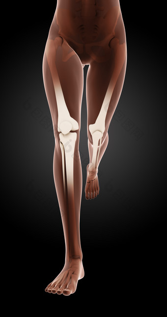 女医疗骨架腿3