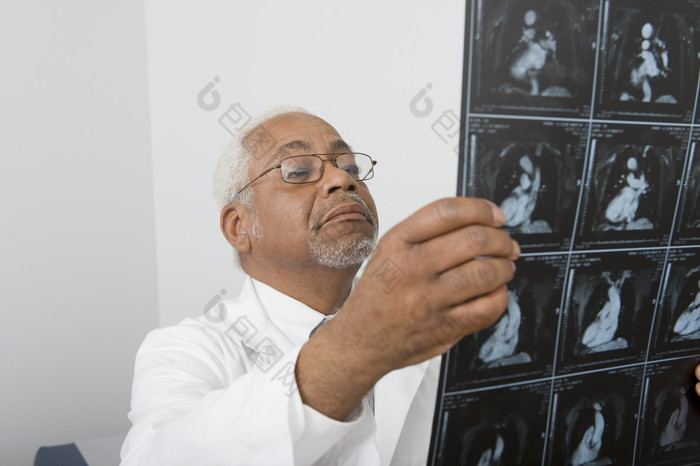 白发老年医生查看片子
