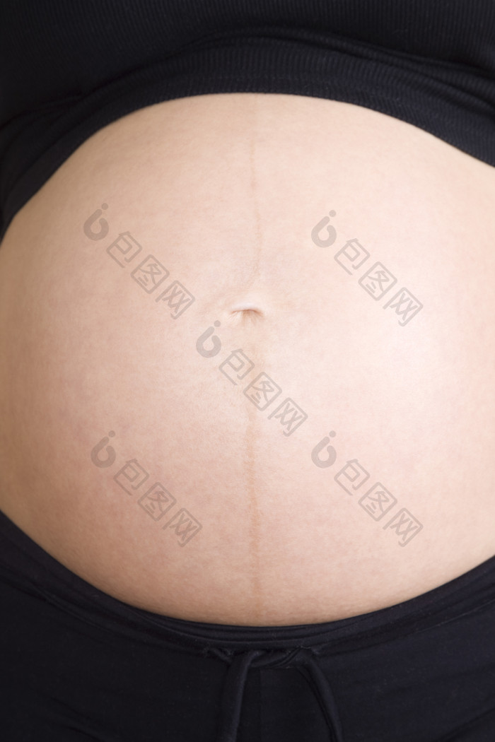 孕妇肚子上的妊娠纹