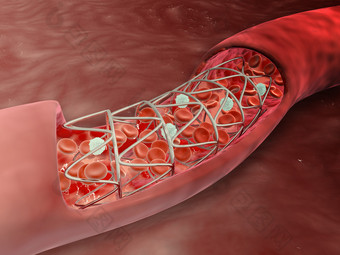 动脉血管结构示例插图
