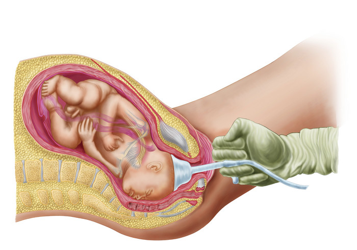 胎儿和母体子宫摄影图