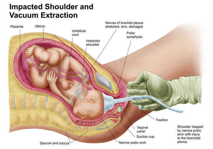 胎儿和子宫摄影图