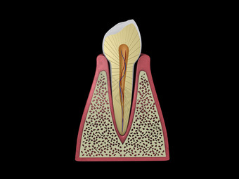 人体牙齿坏牙摄影图