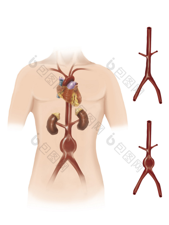 人体动脉示例结构插图