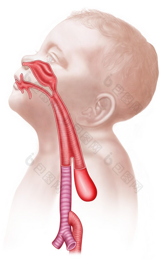 <strong>人体</strong>食道气管示例插图