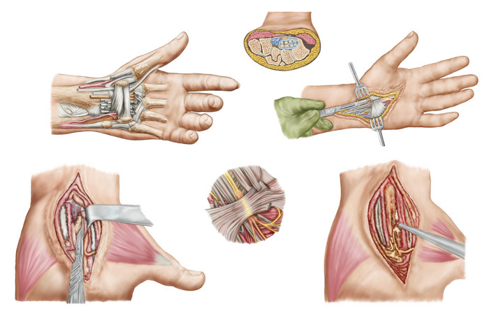 人体手部组织结构