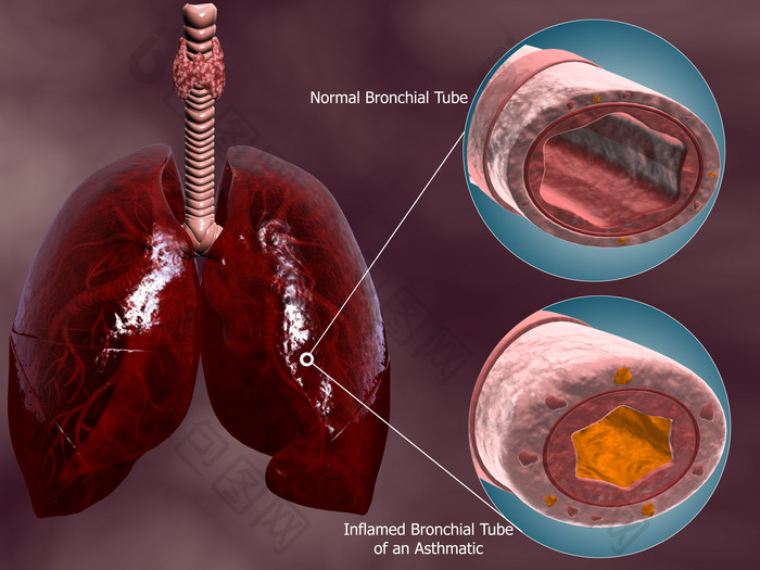 人体肺部气管示例图