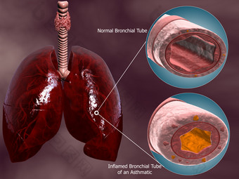 人体<strong>肺部</strong>气管示例图