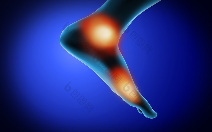 脚部疼痛示例插图图片-包图网