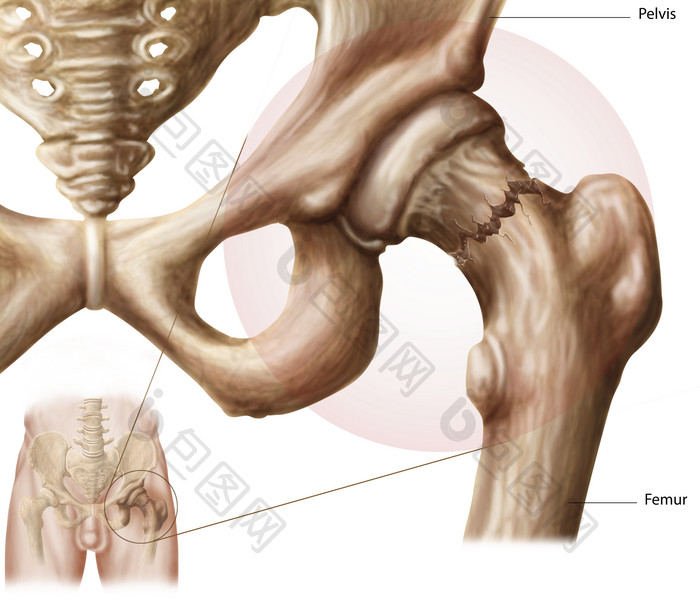 人体骨骼骨架示例插图