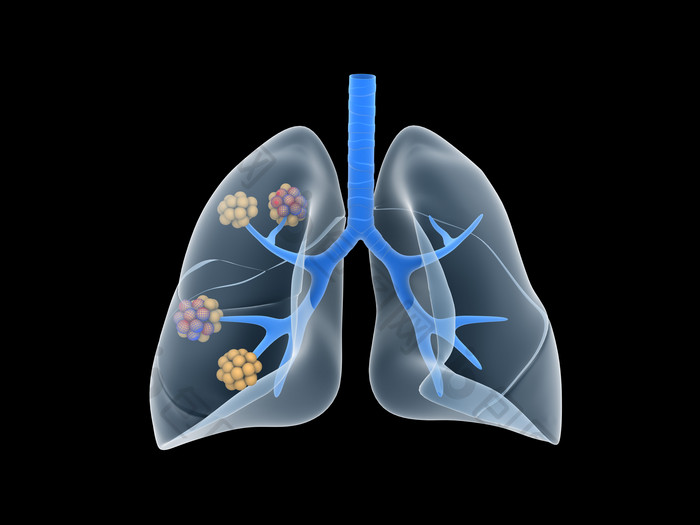 人体肺部病毒摄影图