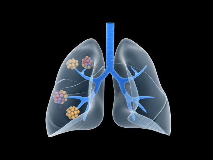 肺部彩图主题照片图片