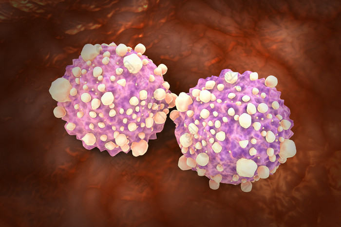 恶性伪足气泡图片