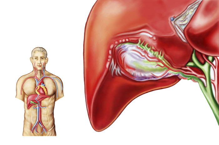 人体肾脏器官模型