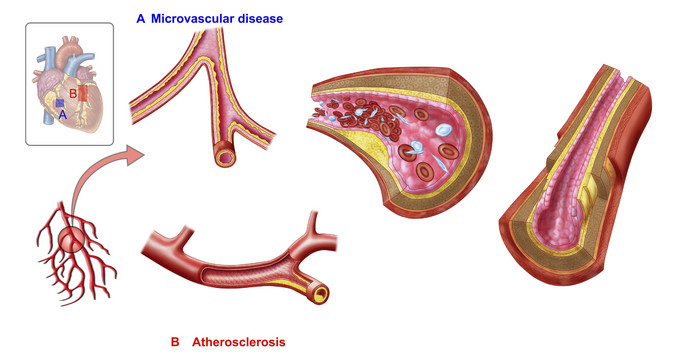 人体动脉血管示例解剖图