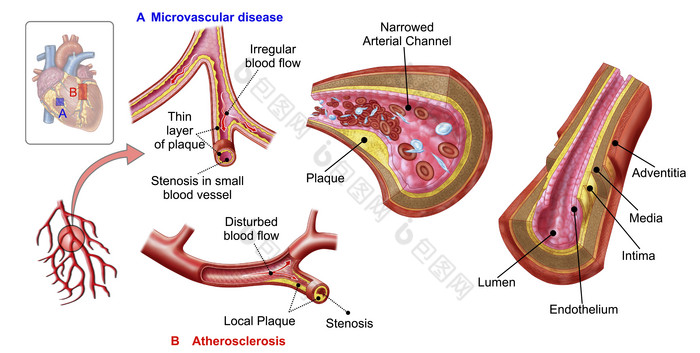 人体动脉外膜解剖示例图
