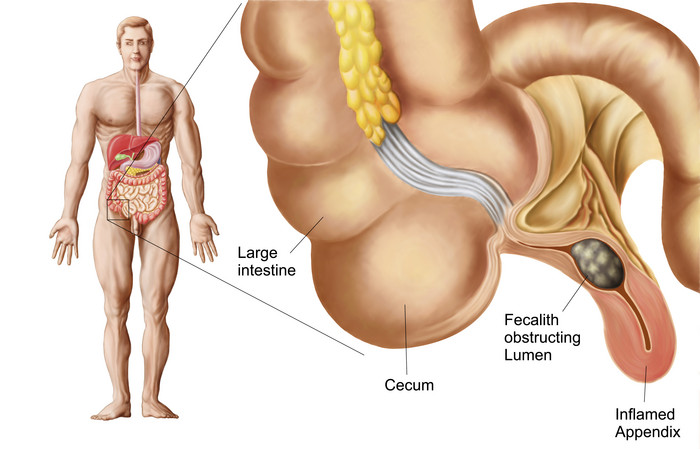 盲肠结石人体内部构造