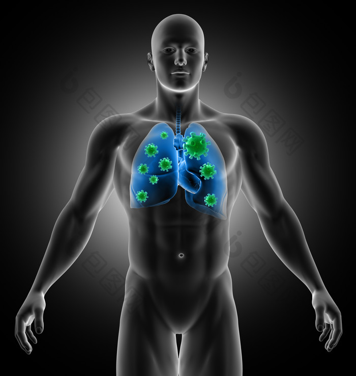 三维立体模拟男性肺部有病毒细胞的医学图像