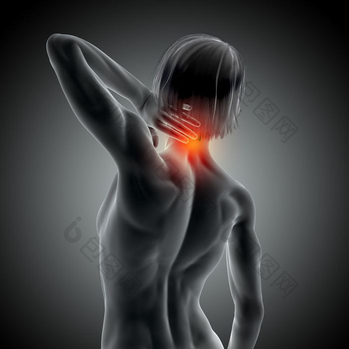 女性颈部疼痛医学图像