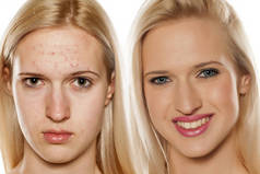 皮肤护理-美容治疗