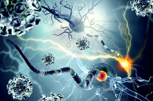 神经细胞、 神经疾病、 <strong>肿瘤</strong>、 脑手术的概念