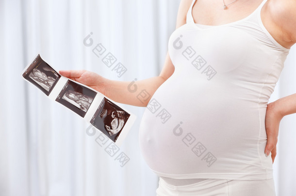 怀孕的女人举行超声<strong>扫描</strong>