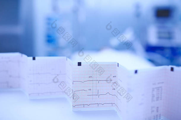 心电图图折叠在护士桌子上的背景
