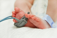 英尺的新出生的婴儿生病在孵化器分庭