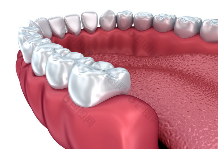 义齿上白色孤立。医学上准确的 3d 图 
