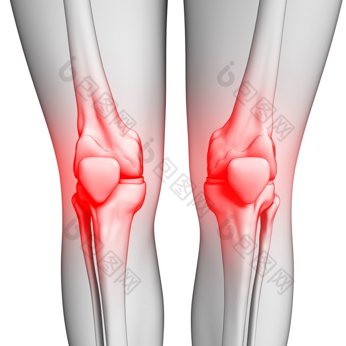 人体膝关节疼痛图稿