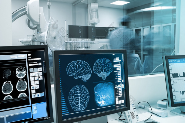 研究、 可视化和实践与人类的大脑在 x 射线 
