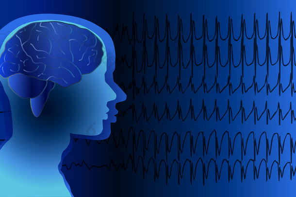 医学背景脑癫痫