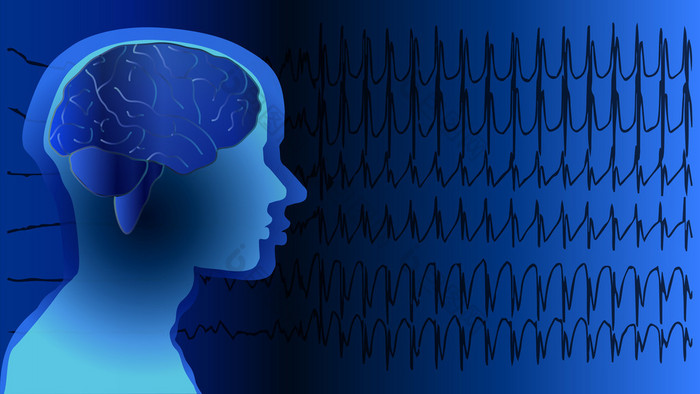 医学背景脑癫痫