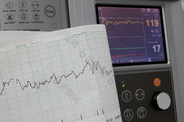 心电图固定和印刷的心率图